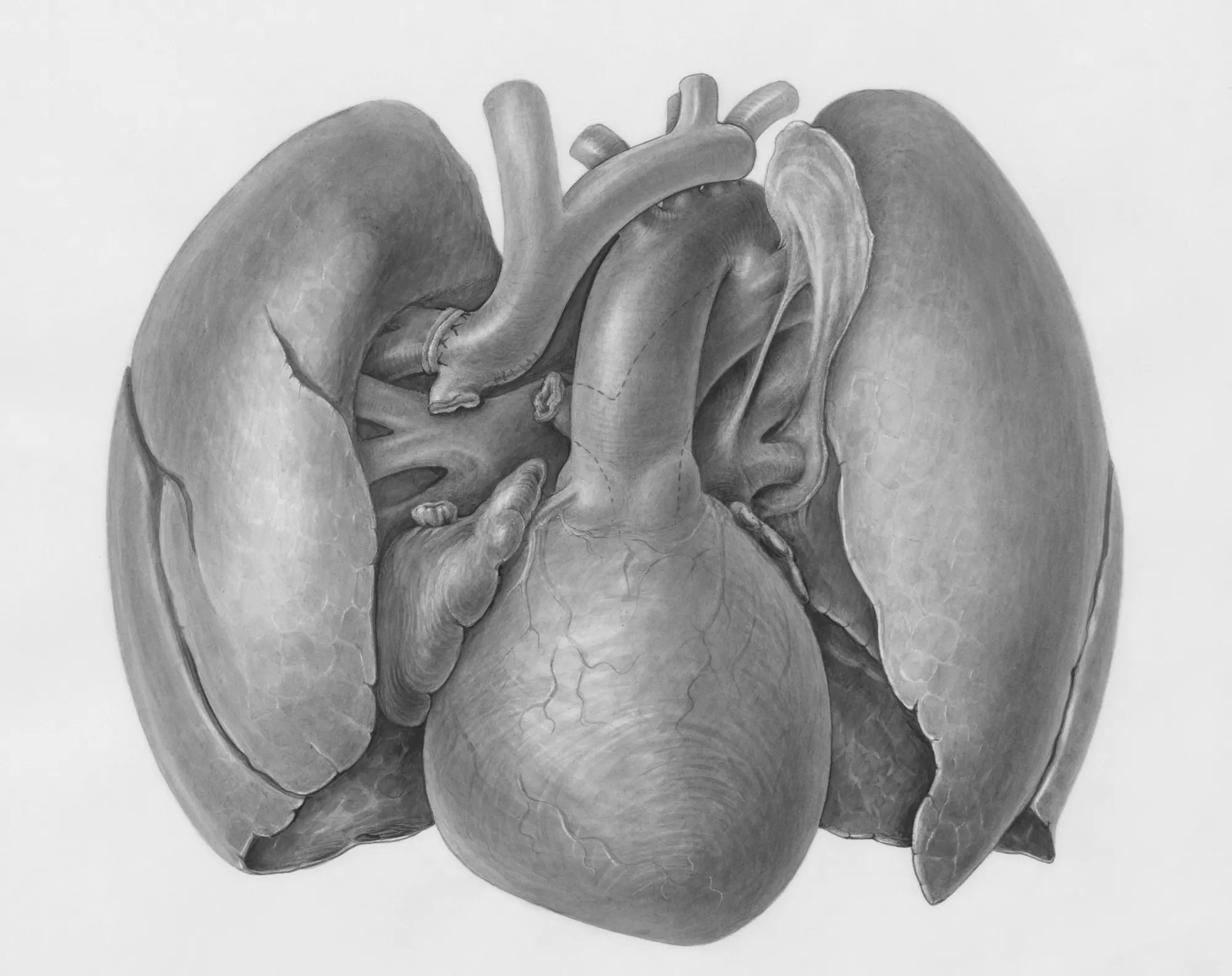 Becoming an organ donor in Amarillo, Texas